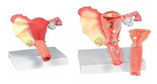 Pathological Model of the Female Reproductive System